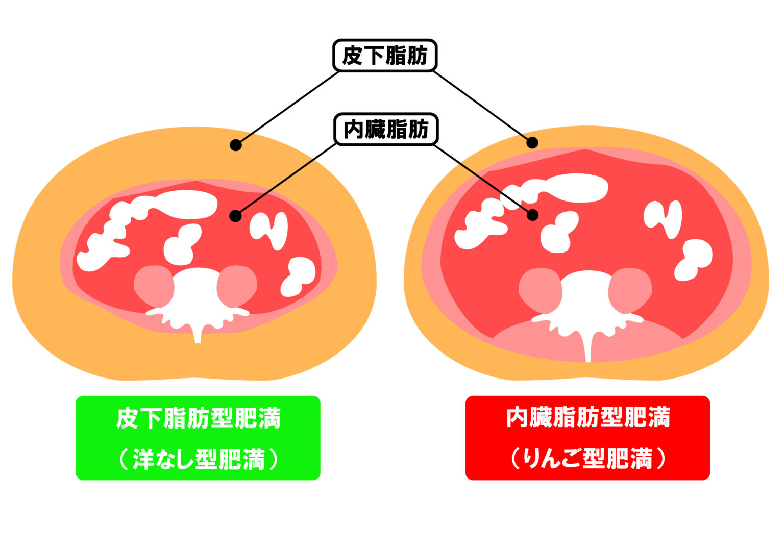 内臓脂肪と皮下脂肪の断面図 一宮市・春日井市でおすすめ 加圧studioTH 内臓脂肪と皮下脂肪の断面図 一宮市・春日井市でおすすめ 加圧studioTH